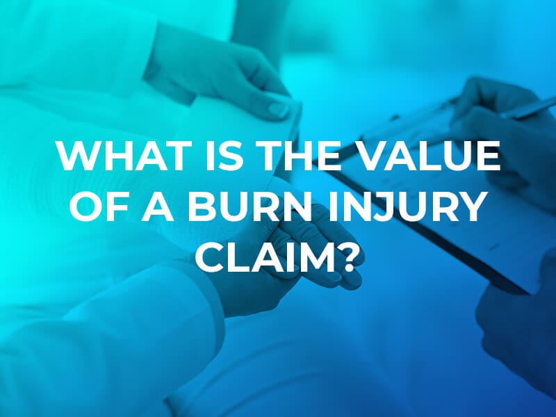 Burn injury claim 