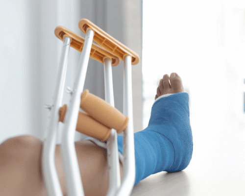 Person with a blue cast on their leg resting near a pair of crutches, implying injury recovery