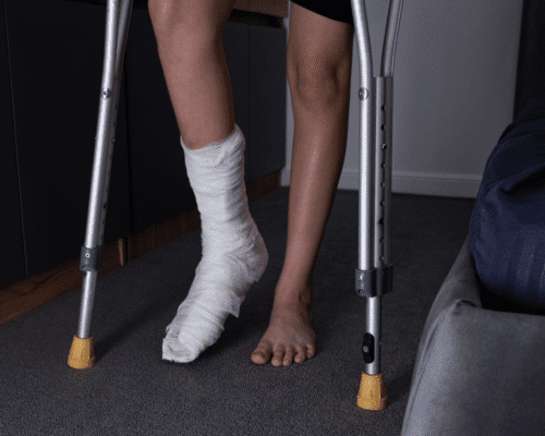 Person using crutches with one leg in a cast, symbolizing injuries caused by defective or recalled products and how Georgia consumers can preserve evidence and pursue product liability lawsuits against negligent manufacturers.